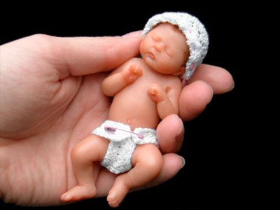 Umudunuzu kaybetmeyin