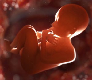 Hamilelikte Sularýn Artmasý, Polihidramnios