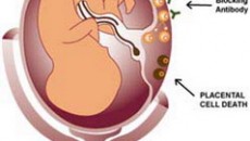 Tam Olmayan Düþük